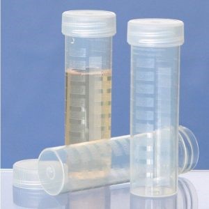 viales de digestión